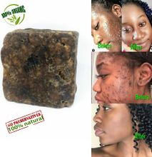 100% Raw Natural Black Soap Acne spots pimples dandruff blackhead remover Smooth skin